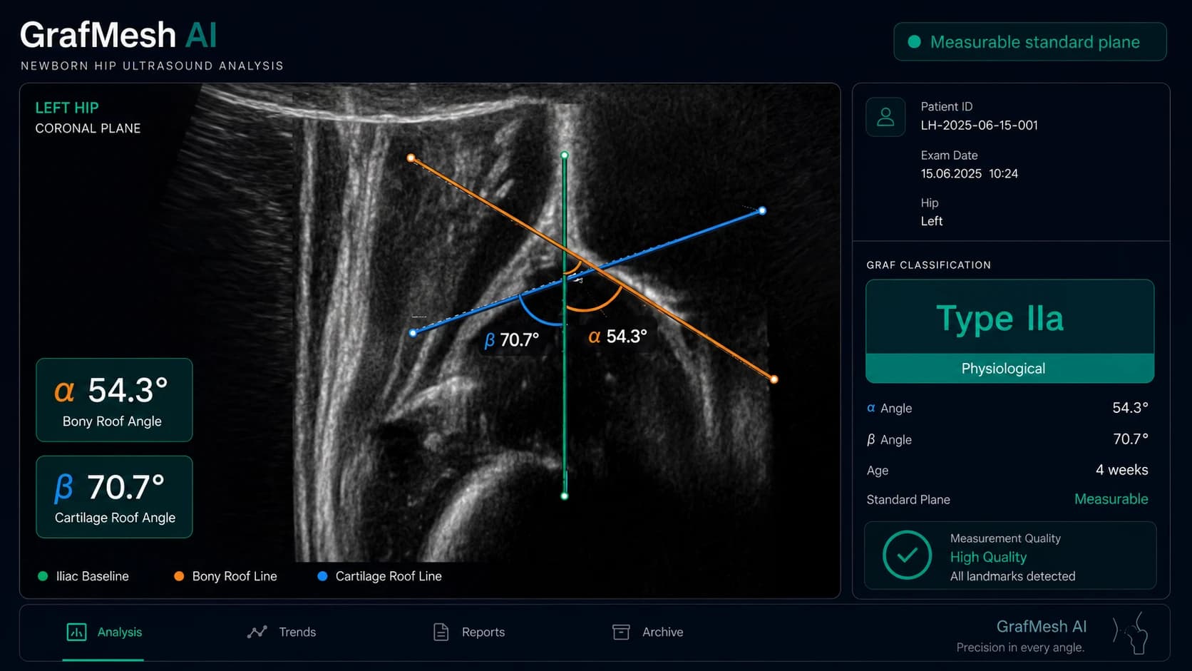 GrafMesh AI: automated α/β angle analysis and Type IIa classification on measurable Graf section